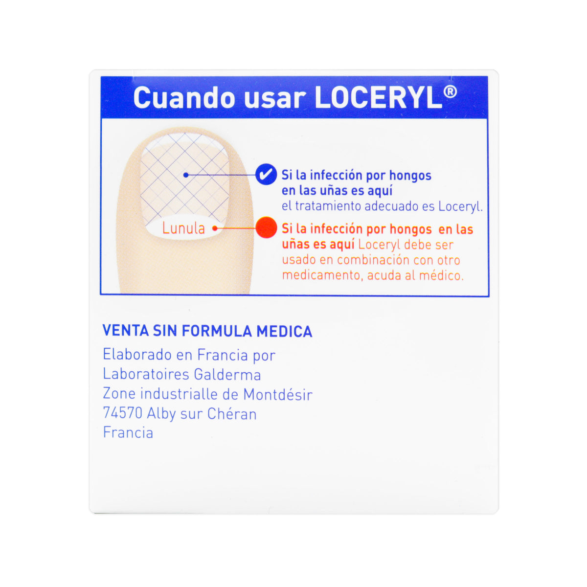 LOCERYL 5% LACA 2.5 ML